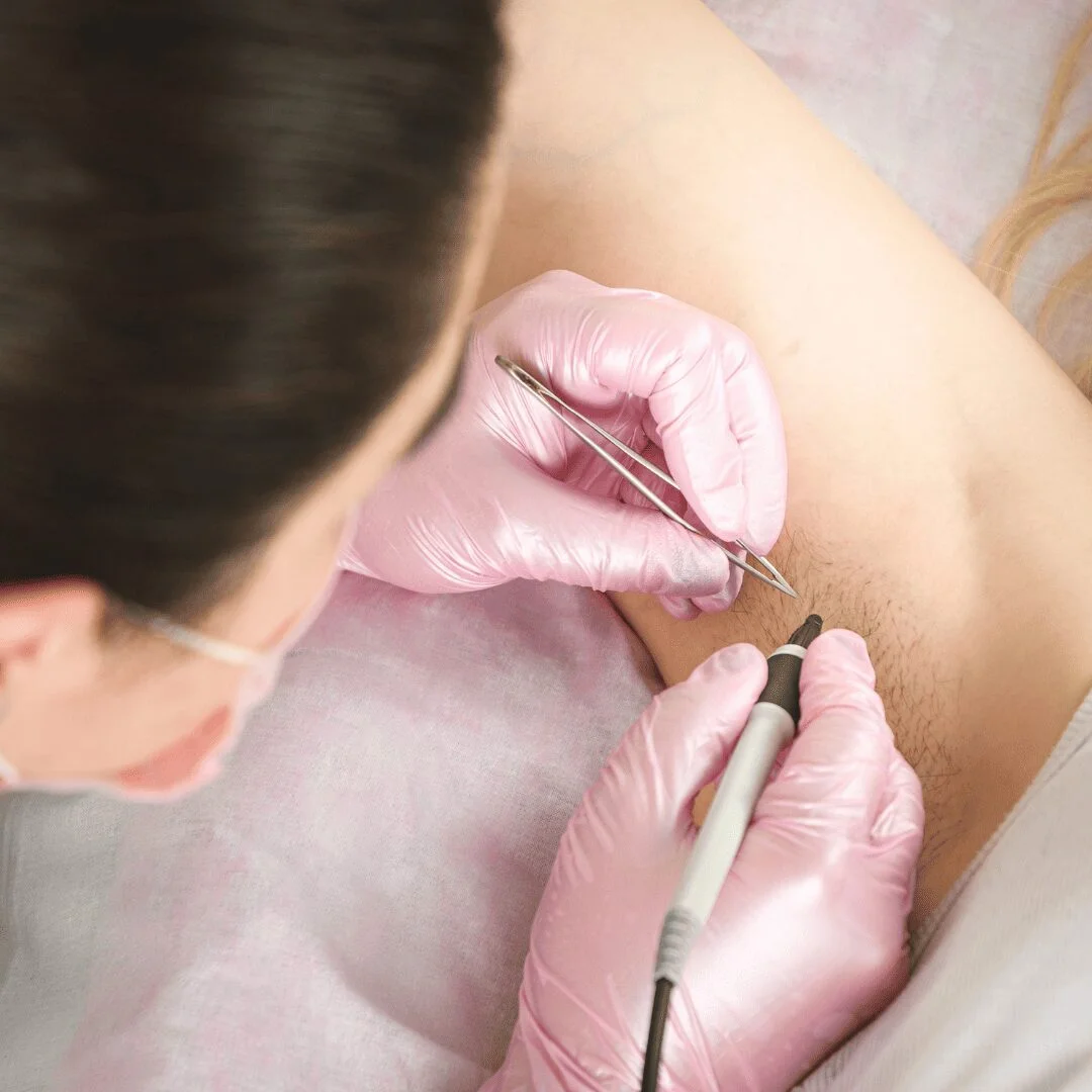 Underarm Hair Removal